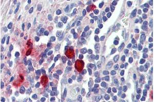 Immunohistochemistry (IHC) image for anti-Chymase 1, Mast Cell (CMA1) (Internal Region) antibody (ABIN768626)