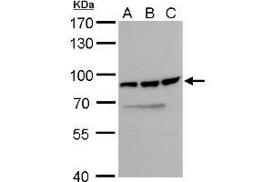 WB Image DDX18 antibody detects DDX18 protein by Western blot analysis.