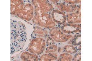 Immunohistochemistry (IHC) image for anti-Sperm Associated Antigen 1 (SPAG1) (AA 1-365) antibody (ABIN5014338)