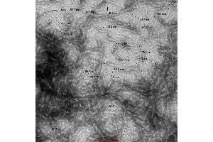 Electron Microscopy (EM) image for Synuclein, alpha (SNCA) (full length) (Active) protein (ABIN5651245)