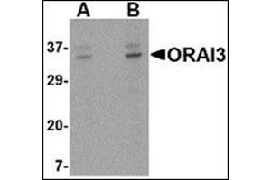 Western blot analysis of ORAI3 in A20 cell lysate with this product at (A) 2 and (B) 4 μg/ml. (ORAI3 抗体  (C-Term))
