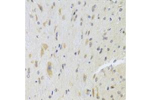 Immunohistochemistry of paraffin-embedded rat spinal cord using DPP3 Antibody (ABIN5975468) at dilution of 1/100 (40x lens). (DPP3 抗体)