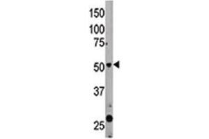 The Beclin 1 antibody used in western blot to detect BECN1 in mouse liver tissue lysate (Beclin 1 抗体  (AA 181-210))