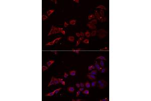 Immunofluorescence analysis of U2OS cells using NRBF2 antibody. (NRBF2 抗体  (AA 10-220))