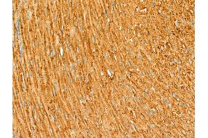 ABIN6264198 and ABIN6266655 at 1/100 staining Rat heart tissue by IHC-P. (PIAS3 抗体  (N-Term))