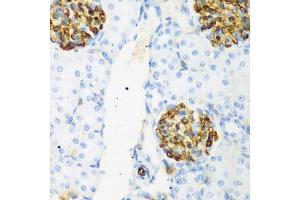 Immunohistochemistry of paraffin-embedded rat kidney using CSRNP1 antibody (ABIN5974288) at dilution of 1/200 (40x lens). (AXUD1 抗体)