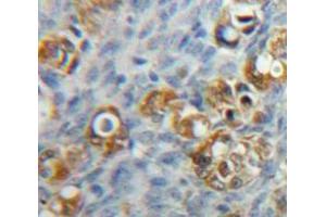 Used in DAB staining on fromalin fixed paraffin-embedded Ovary tissue (F11R 抗体  (AA 64-249))
