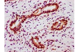 Immunohistochemistry (IHC) image for anti-Signal Transducer and Activator of Transcription 5A (STAT5A) (pTyr694) antibody (ABIN7127756)