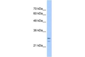 Western Blotting (WB) image for anti-Signal Recognition Particle Receptor, B Subunit (SRPRB) antibody (ABIN2463283) (SRPRB 抗体)