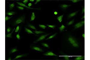 Immunofluorescence of monoclonal antibody to PRKCD on HeLa cell. (PKC delta 抗体  (AA 577-676))
