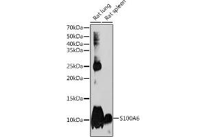 Western blot analysis of extracts of various cell lines, using S100 Rabbit mAb (ABIN7270127) at 1:1000 dilution. (S100A6 抗体)