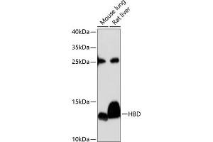 Western blot analysis of extracts of various cell lines, using HBD antibody (ABIN6132879, ABIN6141642, ABIN6141643 and ABIN6224938) at 1:3000 dilution. (HBd 抗体  (AA 1-147))
