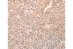 Immunohistochemistry (IHC) image for anti-Transient Receptor Potential Cation Channel, Subfamily C, Member 3 (TRPC3) antibody (ABIN2426987) (TRPC3 抗体)