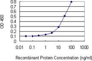 Detection limit for recombinant GST tagged GEMIN4 is 1 ng/ml as a capture antibody. (GEMIN4 抗体  (AA 959-1057))