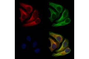 ABIN6262730 and ABIN6266734 staining Hela cells by IF/ICC. (Adenylate Kinase 1 抗体  (Internal Region))