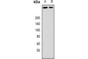 Western blot analysis of ANKHD1 expression in mouse brain (A), rat brain (B) whole cell lysates.