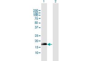 Western Blot analysis of ZNF576 expression in transfected 293T cell line by ZNF576 MaxPab polyclonal antibody. (ZNF576 抗体  (AA 1-170))