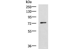 Western blot analysis of Mouse thymus tissue lysate using L3MBTL2 Polyclonal Antibody at dilution of 1:1000 (L3MBTL2 抗体)
