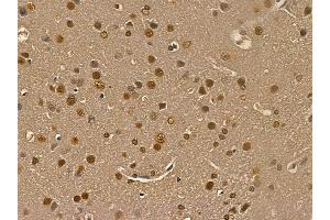 IRAK1 Mouse Monoclonal Antibody at 1/100 staining rat brain tissue by IHC-P. (IRAK1 抗体  (Internal Region))