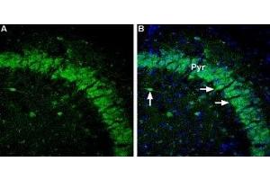 Immunohistochemistry (IHC) image for anti-gamma-aminobutyric Acid (GABA) A Receptor, alpha 5 (GABRA5) (AA 364-376) antibody (ABIN7043189)