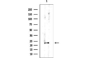 Western blot analysis of lysates from EC304 cells, using PSMB5 Mouse Monoclonal Antibody at 1/1000 dilution.