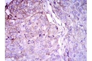 Immunohistochemistry (IHC) image for anti-RAB4A, Member RAS Oncogene Family (RAB4A) antibody (ABIN1108812)