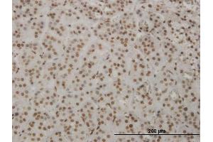 Immunoperoxidase of monoclonal antibody to HMX2 on formalin-fixed paraffin-embedded human adrenal gland. (HMX2 抗体  (AA 125-224))