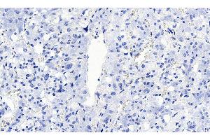 ABIN5855385 Negative Control showing staining of paraffin embedded Human Lung, with no primary antibody. (SLC18A2 抗体)