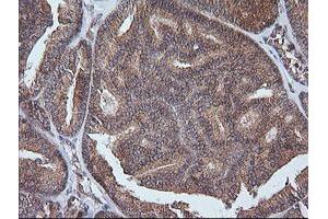 Image no. 1 for anti-V-Ets Erythroblastosis Virus E26 Oncogene Homolog 2 (ETS2) (AA 90-349) antibody (ABIN1491702) (ETS2 抗体  (AA 90-349))