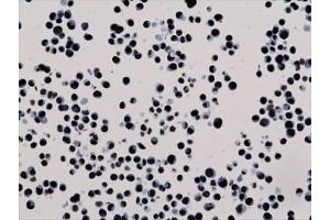 ICC testing of human HepG2 cells with recombinant H3K27me3 antibody.