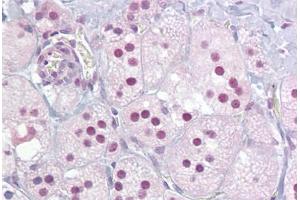 Anti-NUR77 antibody IHC staining of human adrenal.