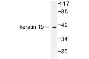 Image no. 1 for anti-Keratin 19 (KRT19) antibody (ABIN265499) (Cytokeratin 19 抗体)