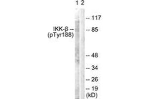 Western blot analysis of extracts from COS7 cells, using IKK-beta (Phospho-Tyr188) Antibody. (IKBKB 抗体  (pTyr188))