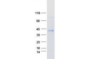 Validation with Western Blot (CHODL Protein (Myc-DYKDDDDK Tag))