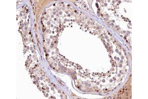 ABIN6266545 at 1/100 staining human Testis tissue sections by IHC-P. (GANP 抗体  (C-Term))