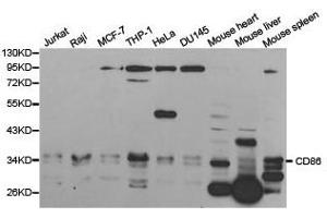 Western Blotting (WB) image for anti-CD86 (CD86) antibody (ABIN1871657) (CD86 抗体)