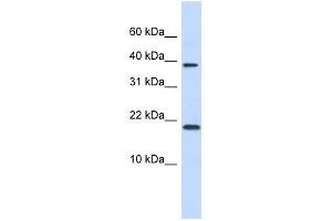 CHRAC1 antibody used at 1. (CHRAC1 抗体  (N-Term))