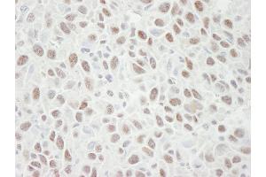 Immunohistochemistry (IHC) image for anti-Minichromosome Maintenance Deficient 4 (MCM4) (AA 750-800) antibody (ABIN7448654)