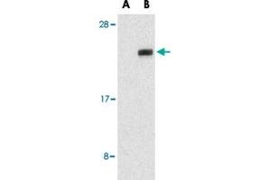 Western blot analysis of NGFRAP1 in human brain tissue lysates with NGFRAP1 polyclonal antibody  at 1 ug/mL in the presence (A) or absence (B) of blocking peptide. (Nerve Growth Factor Receptor (TNFRSF16) Associated Protein 1 (NGFRAP1) (Internal Region) 抗体)