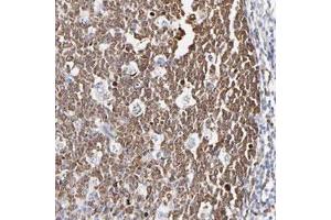 Immunohistochemical staining of human tonsil with NCAPH polyclonal antibody  shows cytoplasmic positivity in reaction center cells. (NCAPH 抗体)