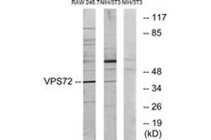 Western Blotting (WB) image for anti-Vacuolar Protein Sorting 72 Homolog (S. Cerevisiae) (VPS72) (AA 131-180) antibody (ABIN2879153) (VPS72 抗体  (AA 131-180))