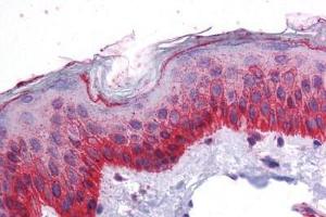 Human Skin: Formalin-Fixed, Paraffin-Embedded (FFPE) (BMP7 抗体  (AA 165-214))