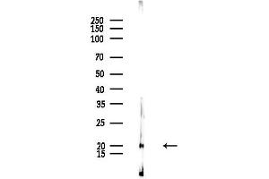 anti-Peptidylprolyl Isomerase F (PPIF) (Internal Region) antibody