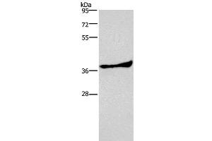 Western Blot analysis of Human fetal liver tissue using AMPK gamma1 Polyclonal Antibody at dilution of 1:300 (PRKAG1 抗体)