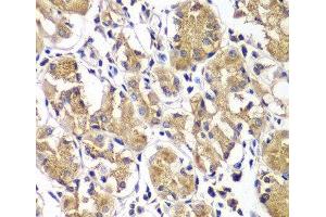 Immunohistochemistry of paraffin-embedded Human gastric using DGKE Polyclonal Antibody at dilution of 1:100 (40x lens). (DGKE 抗体)
