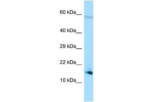 WB Suggested Anti-SPEM1 Antibody Titration: 1.