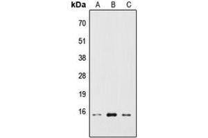 Western blot analysis of RPS19BP1 expression in HEK293T (A), Raw264. (RPS19BP1 抗体  (Center))