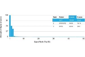 Analysis of Protein Array containing more than 19,000 full-length human proteins using AKT1 Mouse Monoclonal Antibody (AKT1/2491).