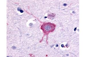 Anti-GRM2 / MGLUR2 antibody IHC of human brain, neurons and glia. (GRM2 抗体  (N-Term))