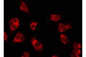Immunofluorescence (fixed cells) (IF/ICC) image for anti-Olfactory Receptor, Family 5, Subfamily H, Member 1 (OR5H1) antibody (ABIN6263887)